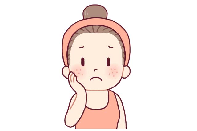 ニキビに悩む女性